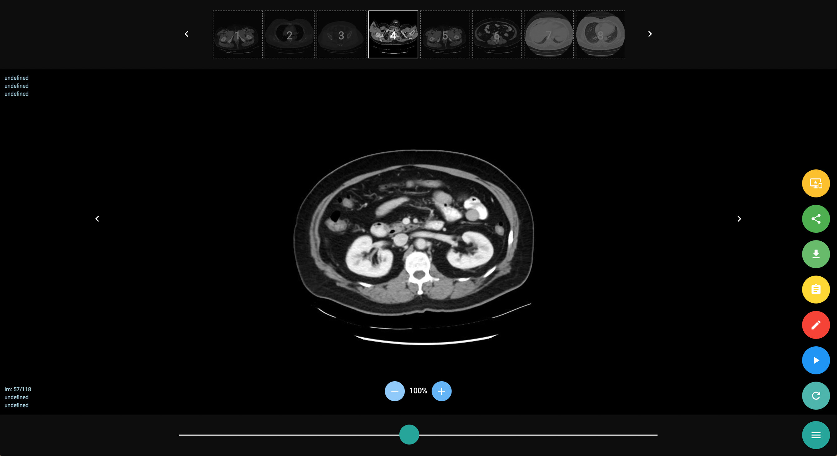 Zed Patient Viewer